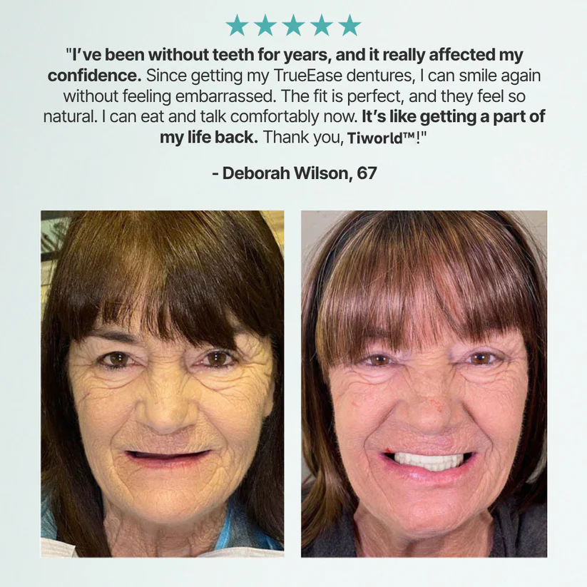 ✨Ends Today: 70% OFF! Audacle⏰ Custom-Fit Full Functional Dentures Make you more confident
